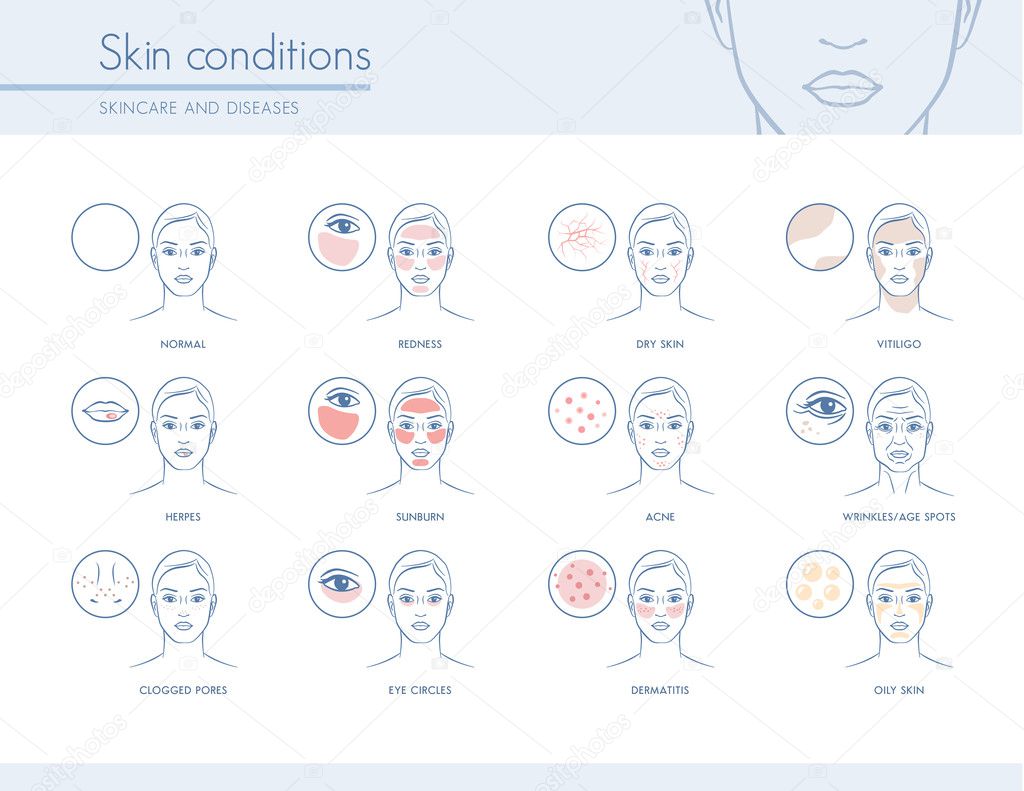 Skin conditions and problems