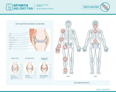 Romatoid artrit, Osteoartrit ve eklem ağrısı ben