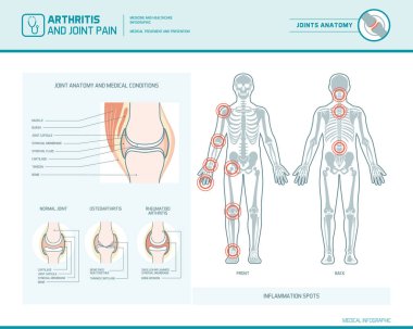 Rheumatoid arthritis, osteoarthritis and joint pain i clipart