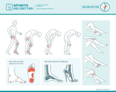 Foot pain, leg pain and arthritis infographic clipart