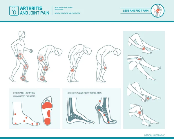 Infografía de dolor de pies, dolor de piernas y artritis — Archivo Imágenes Vectoriales