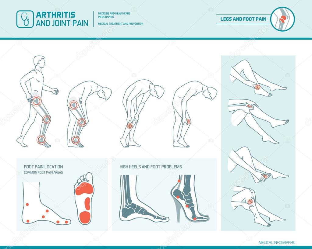 Foot pain, leg pain and arthritis infographic