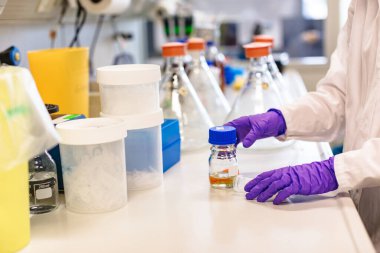 Ellerinde idrar tüpü tutan eldivenlerle ellerini kapat.