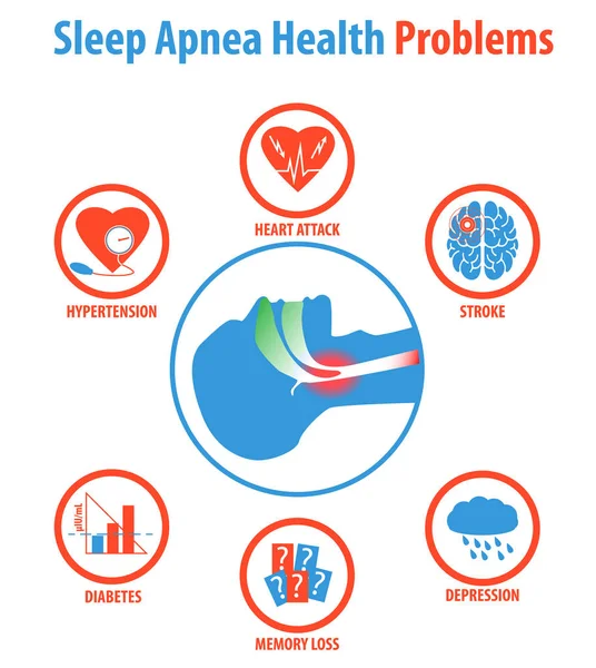 Apneia do sono: tratamentos, causas, sintomas e problemas de saúde . —  Vetores de Stock