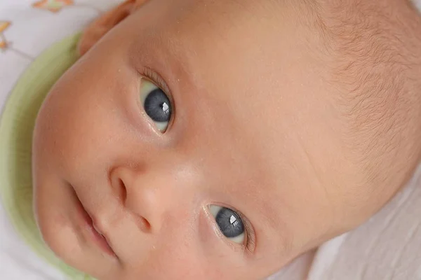 Деталь новонародженого дитячого обличчя, що має жовтяницю . — стокове фото