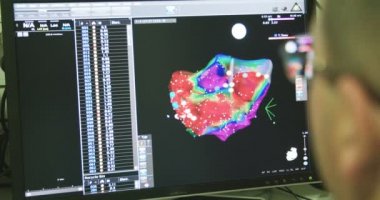 Monitörler tıbbi veri görüntüleme 