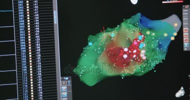 Monitörler tıbbi veri görüntüleme 