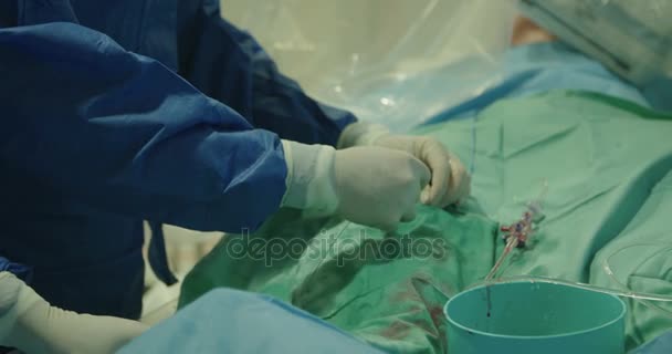 Surgeons preforming cardiac catheterization — Stock Video