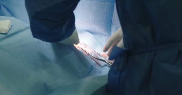 Surgeon preparing for pacemaker transplant — Stock Video