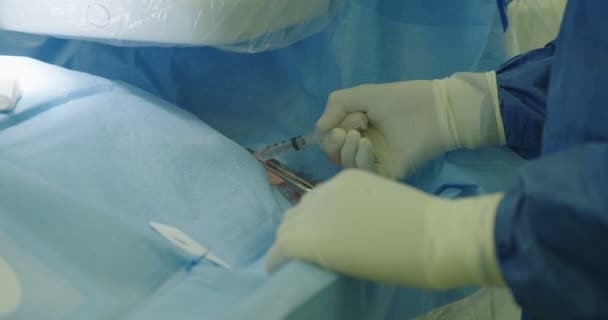 Surgeons preforming cardiac catheterization — Stock Video