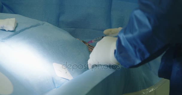 Chirurdzy preforming cewnikowania serca — Wideo stockowe