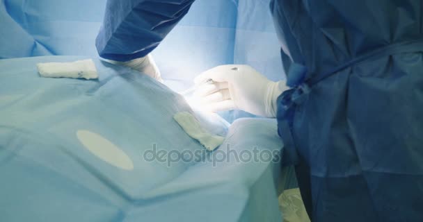 Chirurgen bereiten Herzkatheterisierung vor — Stockvideo