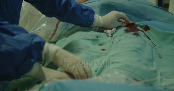 Chirurgen preforming hart catheterisatie — Stockvideo