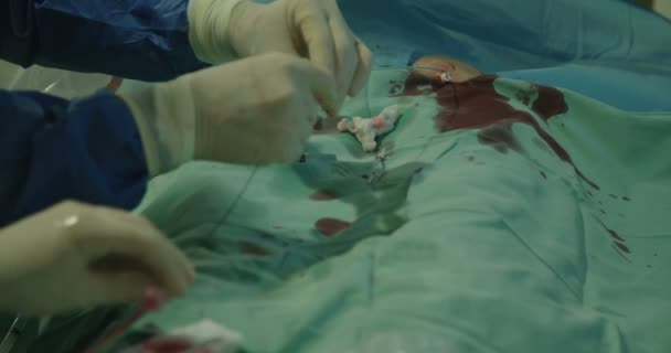 Surgeons preforming cardiac catheterization — Stock Video