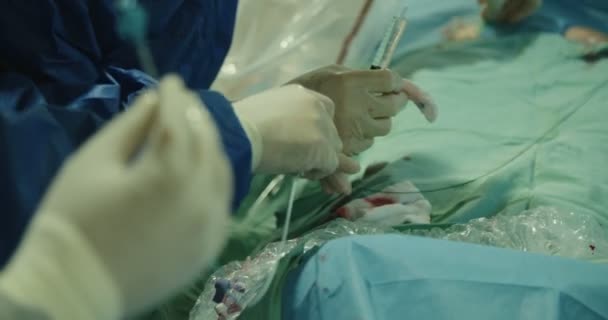 Cirurgiões que pré-formam cateterismo cardíaco — Vídeo de Stock