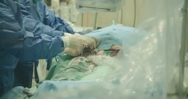 Surgeons preforming cardiac catheterization — Stock Video