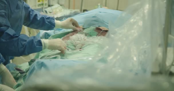 Хірурги попередньої катетеризації серця — стокове відео