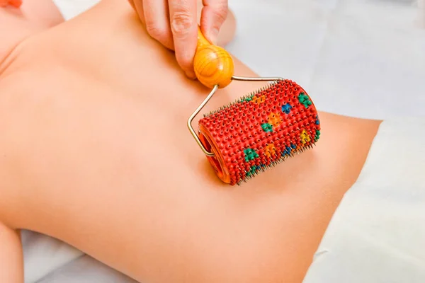 Massagem rolo de cura com agulhas na parte de trás do paciente — Fotografia de Stock