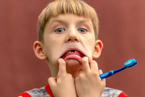 Ein Kind mit einer Zahnbürste in der Hand zeigt einen zahnlosen Mund, der seine Wangen anschwillt. — Stockfoto