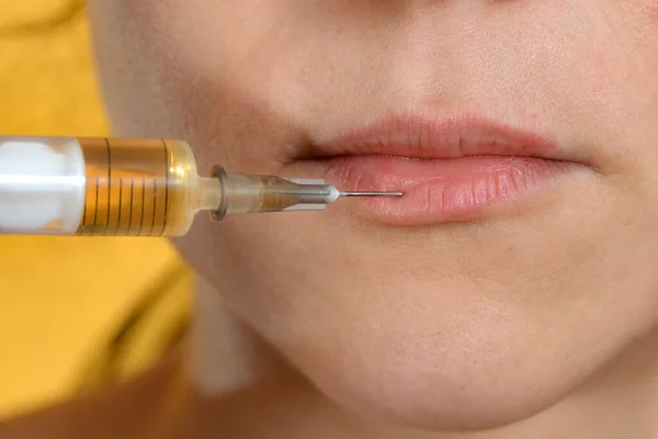 Lip injections with a syringe for lip augmentation in a beauty salon.