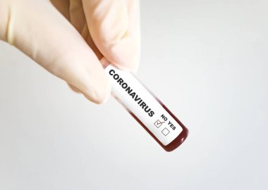 Koronavirüs tarafından enfekte olmuş kan test tüpü