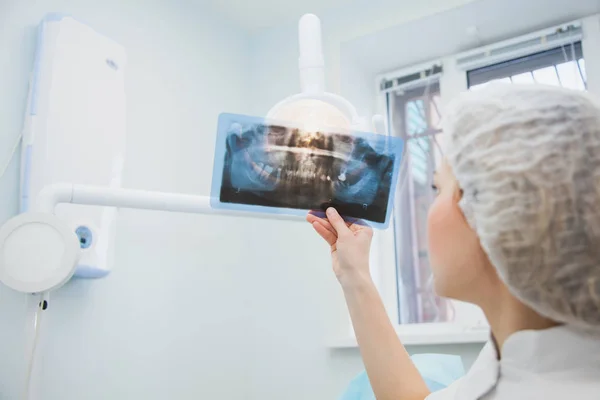 Kobieta lekarz dentysta badanie rentgenowskie ludzkiej szczęki — Zdjęcie stockowe