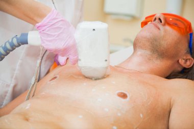 Genç adam için lazer tüy çıkarma prosedürü.