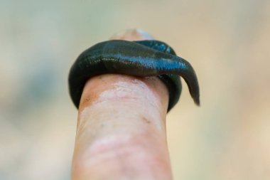 Parmak çevresinde at sülük (Haemopis sanguisuga)