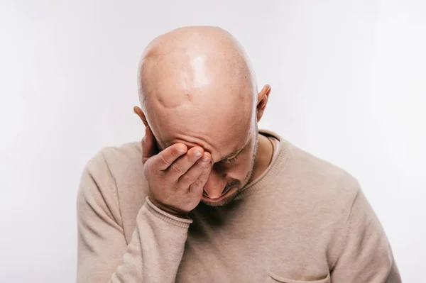 Bald man psychological stress struggling for life arter brain tumor. Heartbreaking male emotions after cancer neurosurgery operation. Oncology survivor patient. Chemotherapy and irradiation head marks