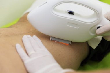 Kalıcı epilasyon Şevval Özçelik Güzellik'ın lazer tedavisi ile