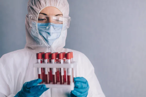 Seorang perawat memegang sampel darah. — Stok Foto