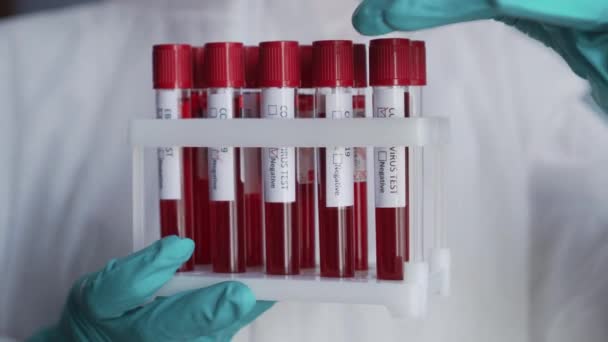 Reagenzglas mit Blut zur Analyse auf Coronavirus. — Stockvideo