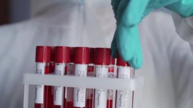 Koronavirüs analizi için kan testi tüpü..