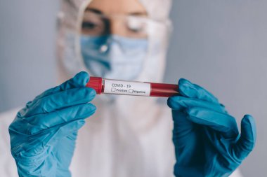 Koronavirüsü test etmek için kan örneğiyle birlikte test tüpü..