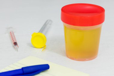 Test ve laboratuvar aletleri için idrar kabı. Tıbbi amaçlar için biyokimyasal bileşim analizi kavramı