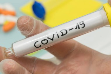 Covid-19 / Coronavirus resmi adı. Elinde laboratuvar eldiveninde virüs olan bir şişe.