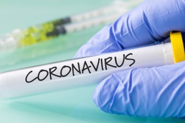 Coronavirus. Mavi eldivenli, elinde virüs olan bir laboratuvar şişesi.