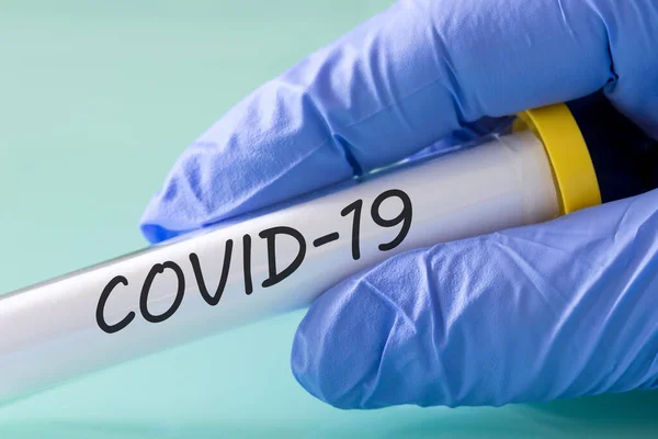 Covid Laborfläschchen Mit Einem Virus Der Hand Einem Blauen Handschuh — Stockfoto