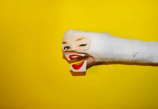 Broken Arm On Yellow Background. Arm in gypsum cast. Medical Art. Hand With Eyes And Mouth. Broken Hand With Make Up. Funny Hand. Hand Injury. Happy Injured Hand. Medical Care for a Broken Hand.