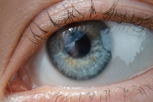 Макрофото Женского Глаза Голубого Цвета Жёлтыми Брызгами — стоковое фото