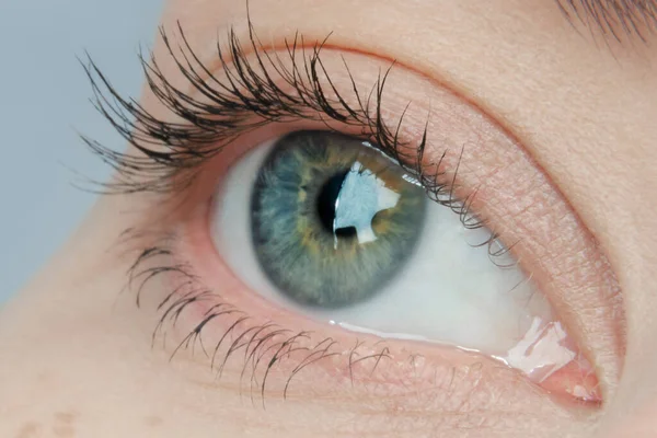 Mavi gözlü, sarı lekeli bir kadının makro fotoğrafı.