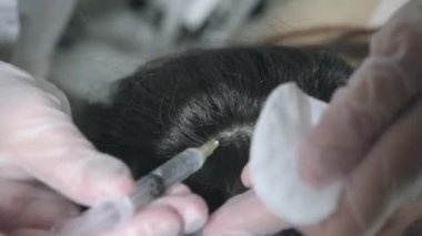 Yakışıklı bir kadın kafasına bir iğne vurulur. Prosedür, doktoru beyaz eldivenli yapar. Mezoterapi kavramı. Saçlarını güçlendirmek ve uzamasını sağlamak için.