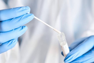 Doktor, 2019 nCoV analizi için tüp bezi tutuyor. Coronavirus testi. Mavi tıbbi eldiven ve kovid 19 virüsüne karşı korunmak için koruyucu yüz maskesi. Koronavirüs ve pandemik.