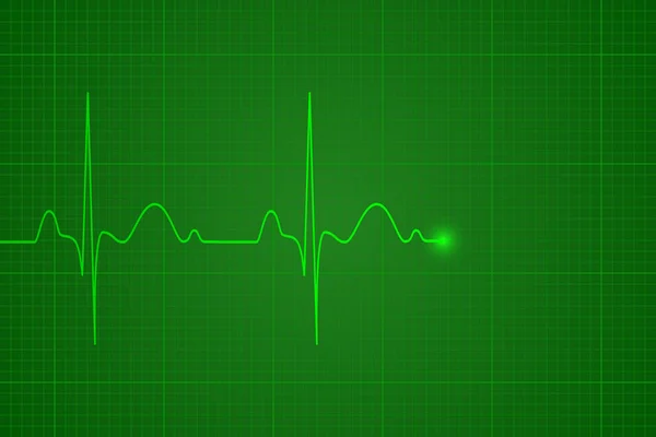 Battito cardiaco sul monitor, sfondo vettoriale — Vettoriale Stock