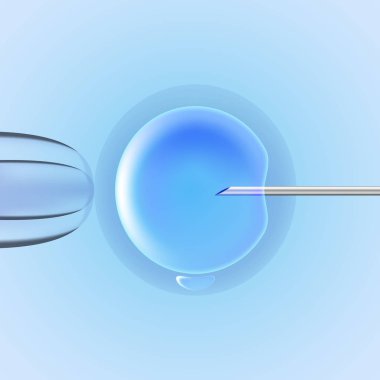 Suni tohumlama, IVF kavramı