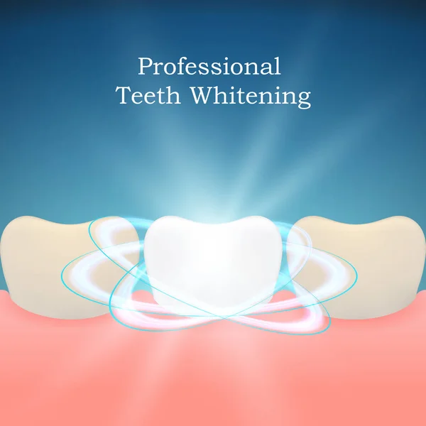 Profesjonalne Wybielanie zębów tło — Wektor stockowy