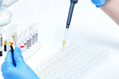 Test tüpü testten geçerse kimyager asistan tutar.