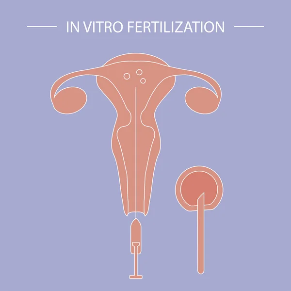 Volante de fertilización in vitro — Vector de stock