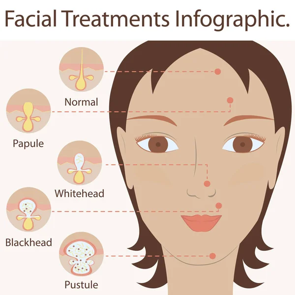 Types of acne pimples — Stock Vector