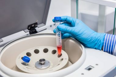Bir tüp bir laboratuvar santrifüje ekleme